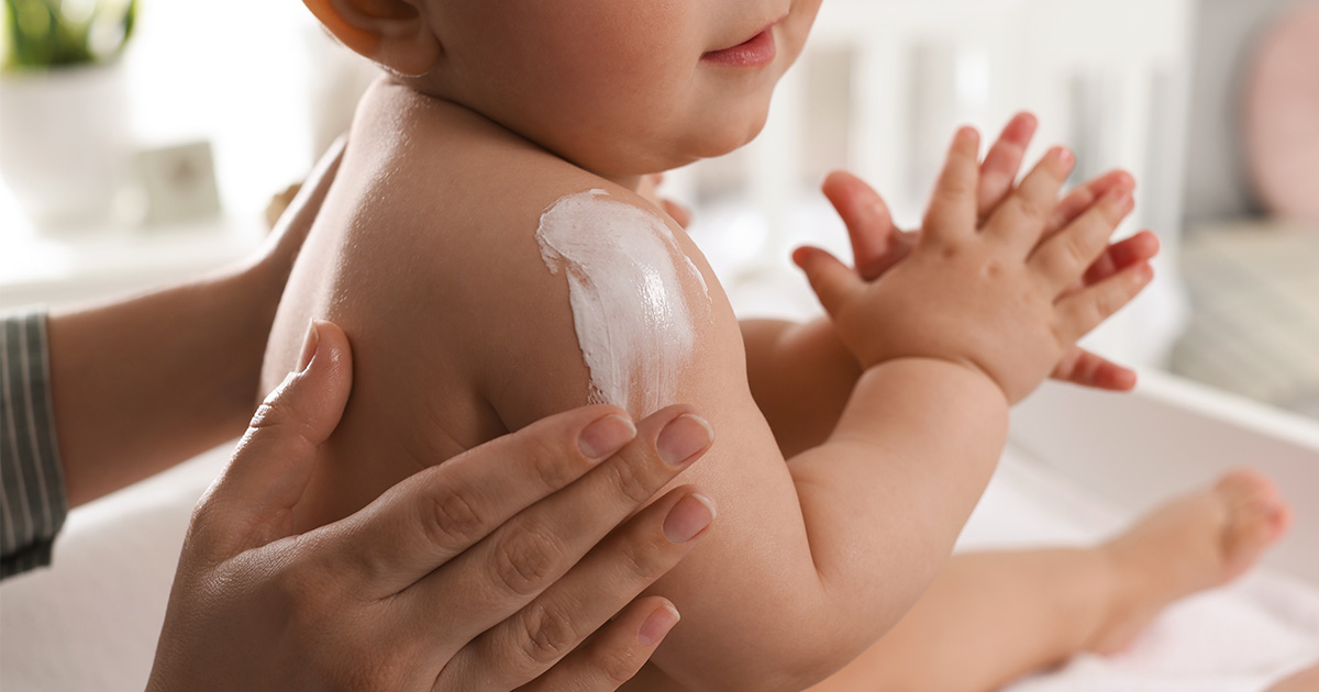 赤ちゃんのアトピー性皮膚炎の特徴について